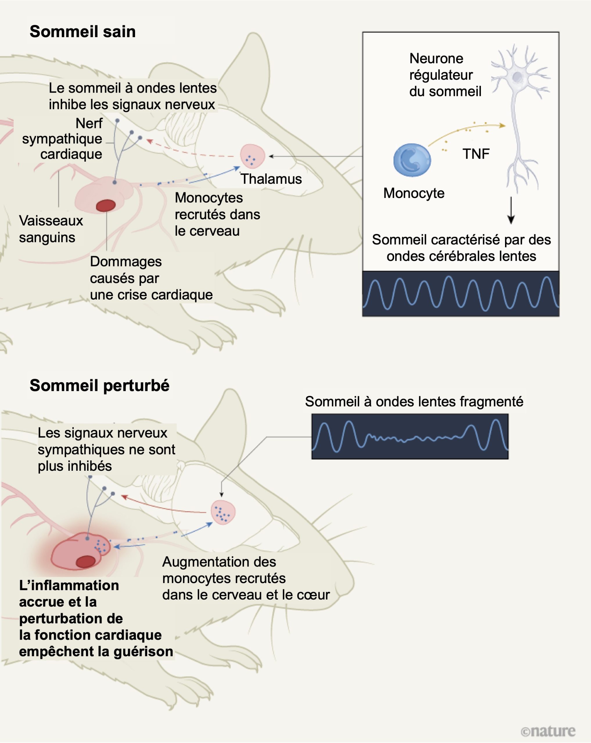 Comment le sommeil participe à la guérison après un infarctus du ...