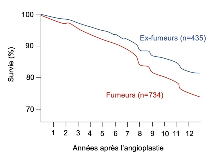 Après une angioplastie, cesser de fumer à l’aide de la cigarette ...